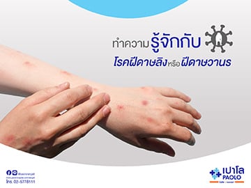 โรคฝีดาษลิง หรือ Monkeypox โรคระบาดใหม่ที่ไม่ควรมองข้าม